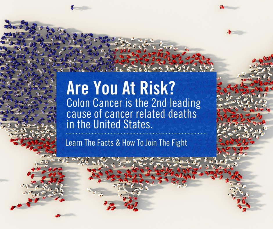 colon-cancer-2nd-leading-cause-of-cancer-deaths-colon-cancer-facts