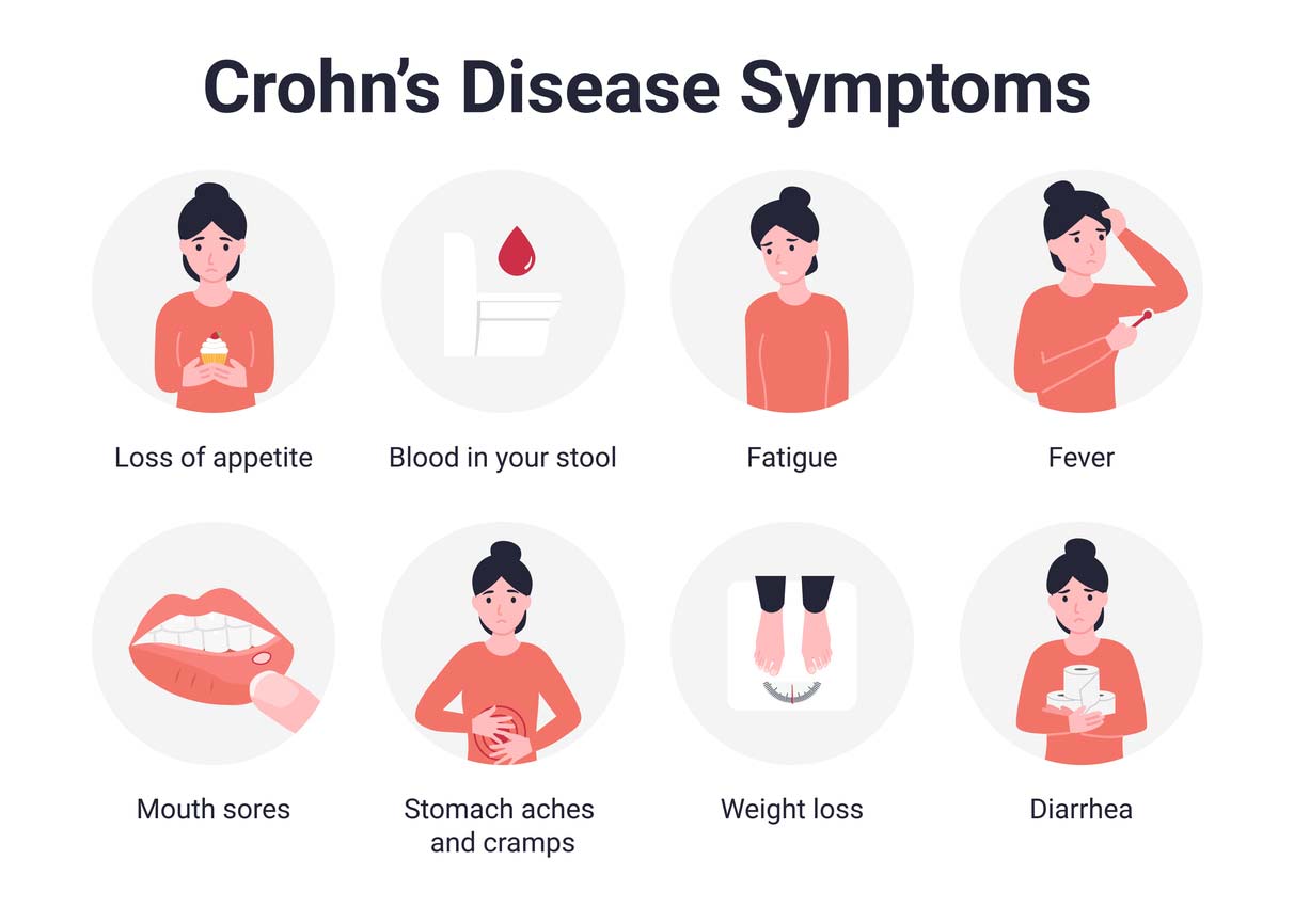 Crohn's disease: symptoms, diet advice and treatment